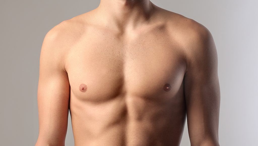 Asymmetrical Gynecomastia, White Plains, NY